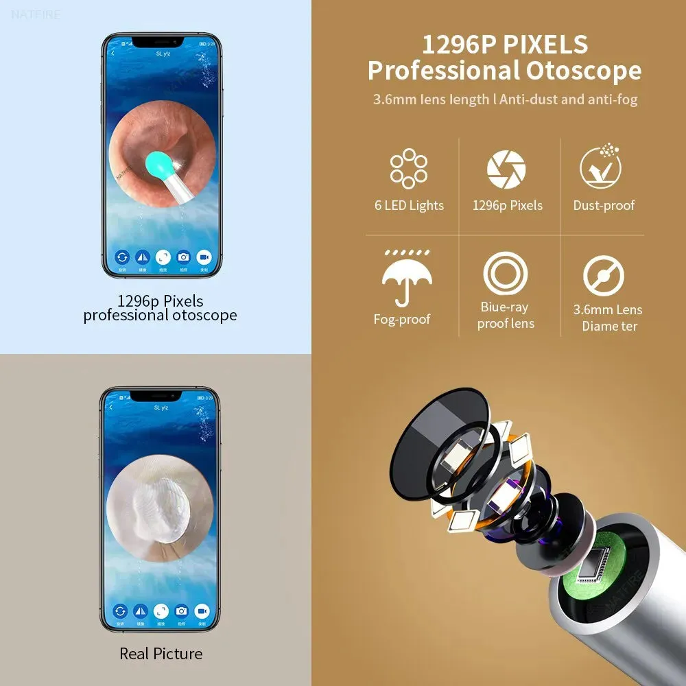 1296p Usb c Ear Cleaner with Camera